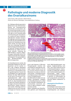 Pathologie und moderne Diagnostik des Ovarialkarzinoms