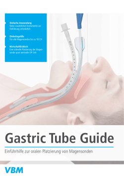 Prospekt Gastric Tube Guide