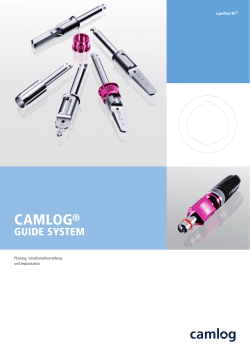 Arbeitsanleitung CAMLOG Guide System 01