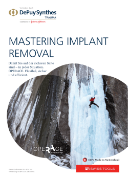 MASTERING IMPLANT REMOVAL
