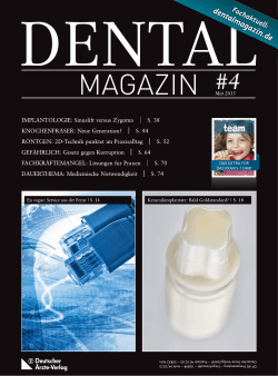 Im Fokus: Keramikimplantate