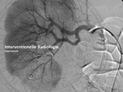 Interventionelle Radiologie. - Instituts f&uuml;r Diagnostische und