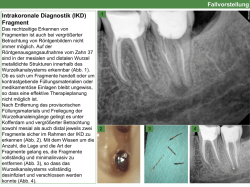 Intrakoronale Diagnostik (IKD)
