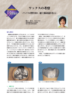 ワックスの考察 - 日本歯科技工士会