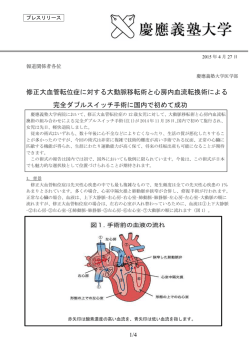 プレスリリース全文(PDF/143KB)