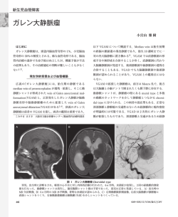 ガレン大静脈瘤