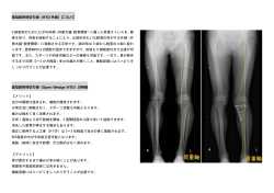 高位脛骨骨切り術（HTO 手術）について O 脚変形のためにひざの内側