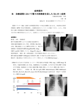 リウマチ肺合併患者の治療症例