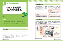 イラストで理解！ IABPの仕組み