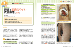 褥瘡と間違えやすい 皮膚疾患（下肢）