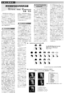 男性型脱毛症の内科的治療