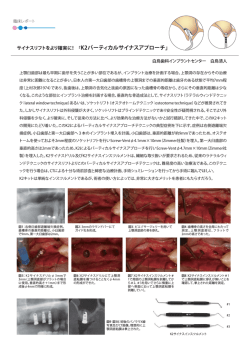 臨床レポート：K2バーティカルサイナスアプローチ