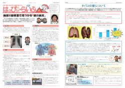胸部X線検査で見つかる「肺の病気」