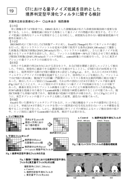 CTにおける量子ノイズ 境界判定型平滑化フィルタに 19 ノイズ低減を