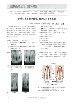 外傷による歯の脱落、 破折に対する処置