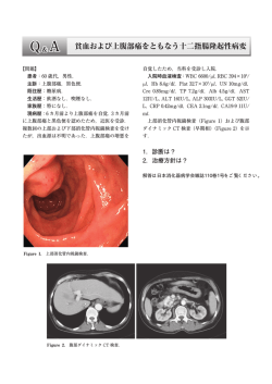 貧血および上腹部痛をともなう十二指腸隆起性病変