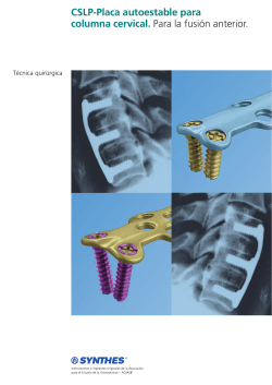 Placa Autoestable para Columna Cervical. T&eacute;cnica