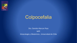 Colpocefalia