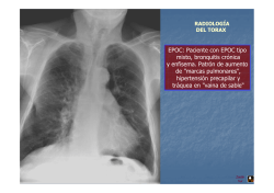 Tórax EPOC-Asma-Bronquiectasias