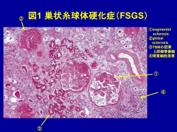 スライド 1 - Nephroma2a