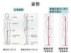 腰部疾患の運動指導 - 労災疾病等研究普及