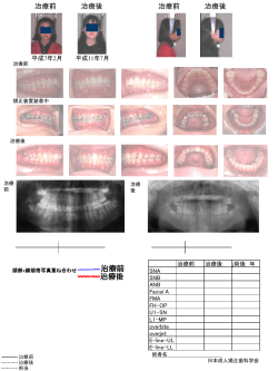 スライド 1 - 日本成人矯正歯科学会
