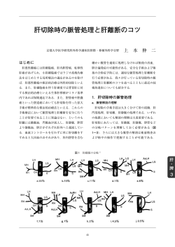肝切除時の脈管処理と肝離断のコツ