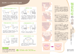 顎変形症 の 治療