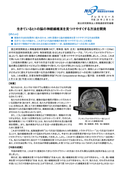 生きているヒトの脳の神経線維束を見つけやすくする方法を開発