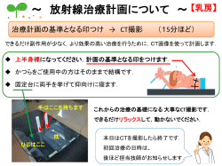 放射線治療案内ONH版