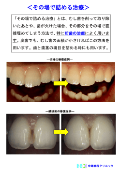＜その場で詰める治療＞