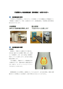子宮頸がんの放射線治療（腔内照射）を受ける方へ