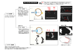パルス法診断 A モード方式 B モード方式 ドップラー法診断 眼の超音波