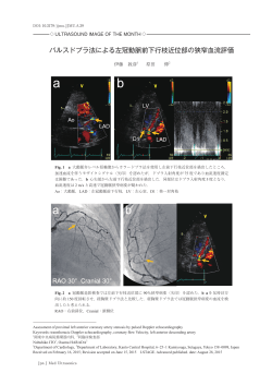 パルスドプラ法による左冠動脈前下行枝近位部の狭窄血流評価