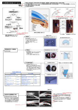 前房隅角検査をする方法 隅角鏡を用いた検査法 gonioscope 直接法