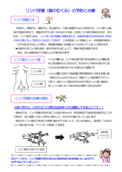 リンパ浮腫（脚のむくみ）の予防と治療