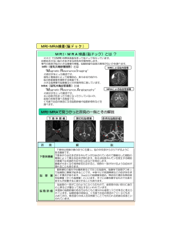 MRI・MRA検査（脳ドック）