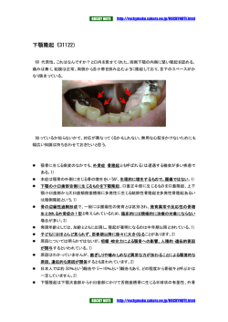 下顎隆起について