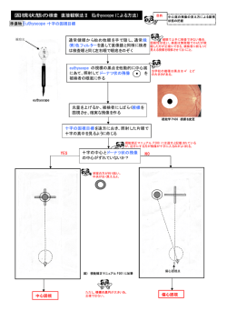 オイチスコープ・ユーティスコープによる方法