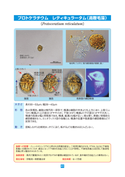 プロトケラチウム レティキュラータム（渦鞭毛藻） （Protoceratium